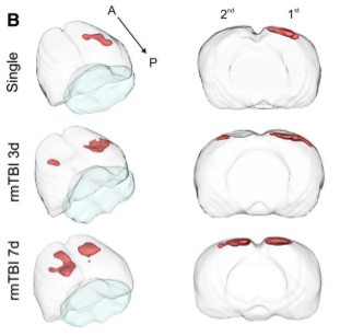 3D reconstruction of injury volume